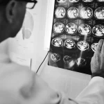 Metástasis cerebrales