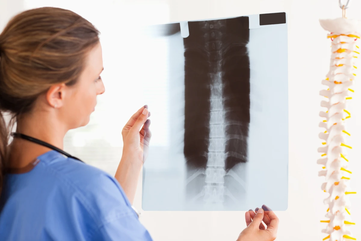 Tratamiento de fracturas vertebrales en Costa Rica | Dr. Andrés