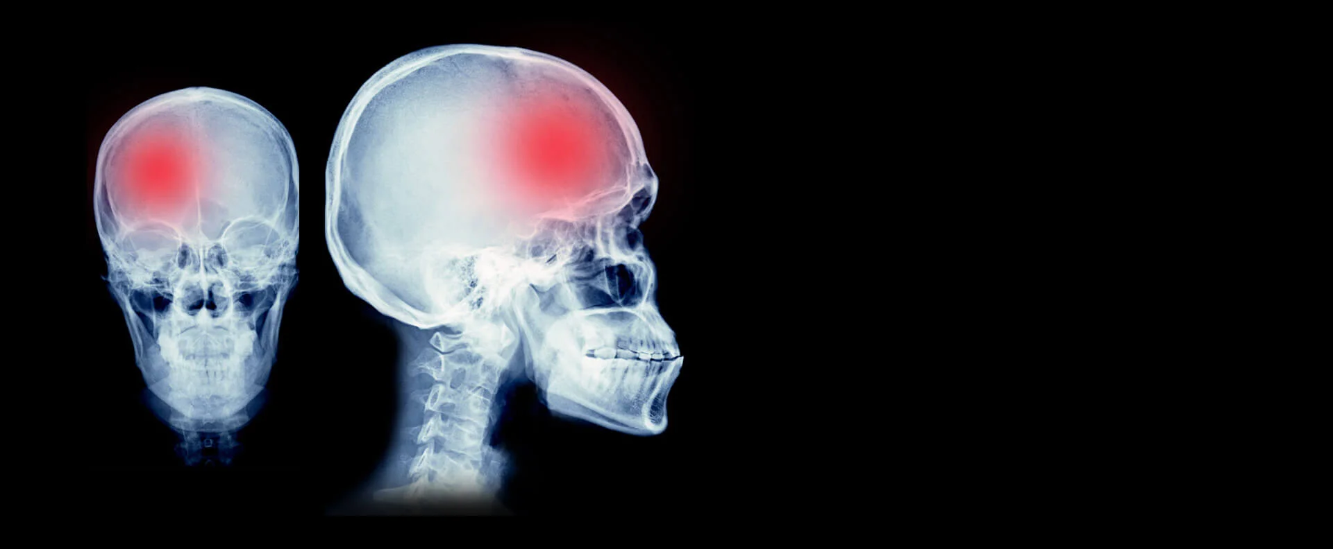 Dr. Andrés Morales | Neurocirujanos en Costa Rica
