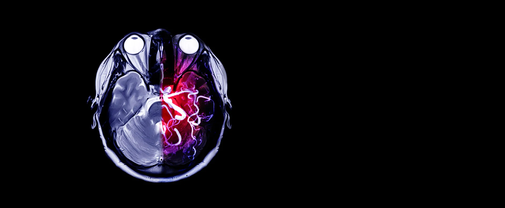 Dr. Andrés Morales | Neurocirujanos en Costa Rica